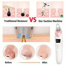 Máy hút mụn đầu đen điện 5 trong 1, làm sạch lỗ chân lông mặt với 5 đầu thay thế, dụng cụ làm đẹp cầm tay dành cho phụ nữ, quà tặng Giáng sinh, 3 tốc độ điều chỉnh, điều trị mụn trứng cá. - Nhiều màu - Xem 10