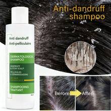 Tratamiento para el cabello anti-caspa shampoo sensible 200ml - cuidado de cabello, productos para el cabello ideal como regalo San Valentín 2025 - Blanco - Ver 2