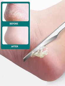 1pc Professional Stainless Steel Foot Scraper, Removes Dead Skin, Foot File, Callus Remover, Unisex Foot Care Tool