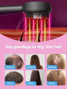 1400mAh 电动头皮按摩梳，红光生发梳，3 种模式，Type-C 充电，红光防脱发头皮护理按摩梳，护发设备，护发精华涂抹器 - 彩色 - 查看 6