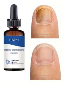TRSTAY Foot Armor Moisturizing Essential Oil, Refreshing And Moisturizing The Skin, Suitable For All Skin Types - Nhiều màu - Xem 4