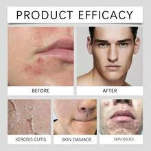 Sérum para después del afeitado para hombre: Un sérum hidratante, confortable y refrescante para el cuidado de la piel después del afeitado. - Blanco - Ver 9