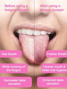 4 Styles Stainless Steel Tongue Scraper, Anti-Rust & Durable, Effectively Cleans Tongue Coating, Removes Bad Breath, Metal Tongue Cleaner, Portable Design, Suitable For Adults, Children And Family Daily Oral Care - 白色 - 查看 4