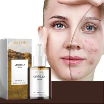 积雪草面部精华液，保湿滋润，改善干燥肌肤，令肌肤光滑柔嫩，提亮肤色，深层补水，适合所有肤质，女性适用，节日礼物，积雪草护肤