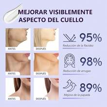 Crema para Cuello: 2PCS Crema Reafirmante Para El Cuello - Reduce las Arrugas y Líneas de Expresión, Reafirma y Levanta la Piel Flácida, Crema Hidratante para el Cuidado de la Piel (2) - 1 - Ver 7