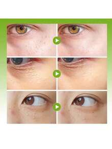 Fat Granules Remover Eye Cream Effective Remove Fat Granules Puffiness Anti-Particles Milia Remover Product Repair Eye Skin Care - 1pcs - 查看 2