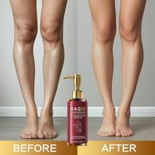 Magic Body Firming Oil | Nourishes Skin, With Natural Oils Reduces Fine Lines,Improves ElasticityHydrating & Tightening Skin Oil For Arms, Legs, Stomach & Full Body | Fast-Absorbing-120ML - Đỏ - Xem 8