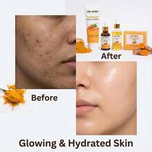 2 件姜黄护肤套装，姜黄精油 + 姜黄皂，姜黄精华 + 姜黄洗面奶，保湿，亮白，芳香且无刺激，适合所有肤质，日常护肤，完美礼物 - 黃色 - 查看 7