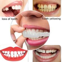 4pcs White Denture Set For Men & Women , Comfortable & Easy To Clean, Perfect For Daily Use & Parties, Yellow & Uneven Teeth Cover, Everyday Denture Set