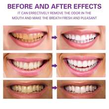 YILEST 紫色牙粉 100克 - 3天美白牙齿。成分：羟基磷灰石、活性炭粉、珍珠粉，薄荷清新，去除牙渍和泛黄，深层清洁，清新口气，牙膏粉，口腔护理。 - 紫色 - 查看 5