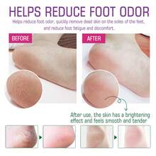 EELHOE 足浴盐 - 滋养肌肤，深层清洁，缓解肌肉酸痛，排毒，温暖双脚 - 薰衣草 - 查看 8