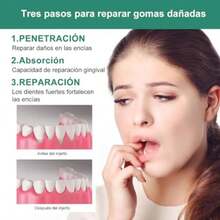 2PCS Gotas para el Crecimiento y Reparación de Encías - Gotas para el Cuidado Bucal - Tratamiento de Atrofia - Reparación de Las Encías - Cuidado Bucal Intensivo - Fórmula Avanzada(default) - Multicolor - Ver 8