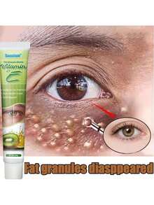 Fat Granules Remover Eye Cream Effective Remove Fat Granules Puffiness Anti-Particles Milia Remover Product Repair Eye Skin Care - 1件 - 查看 2