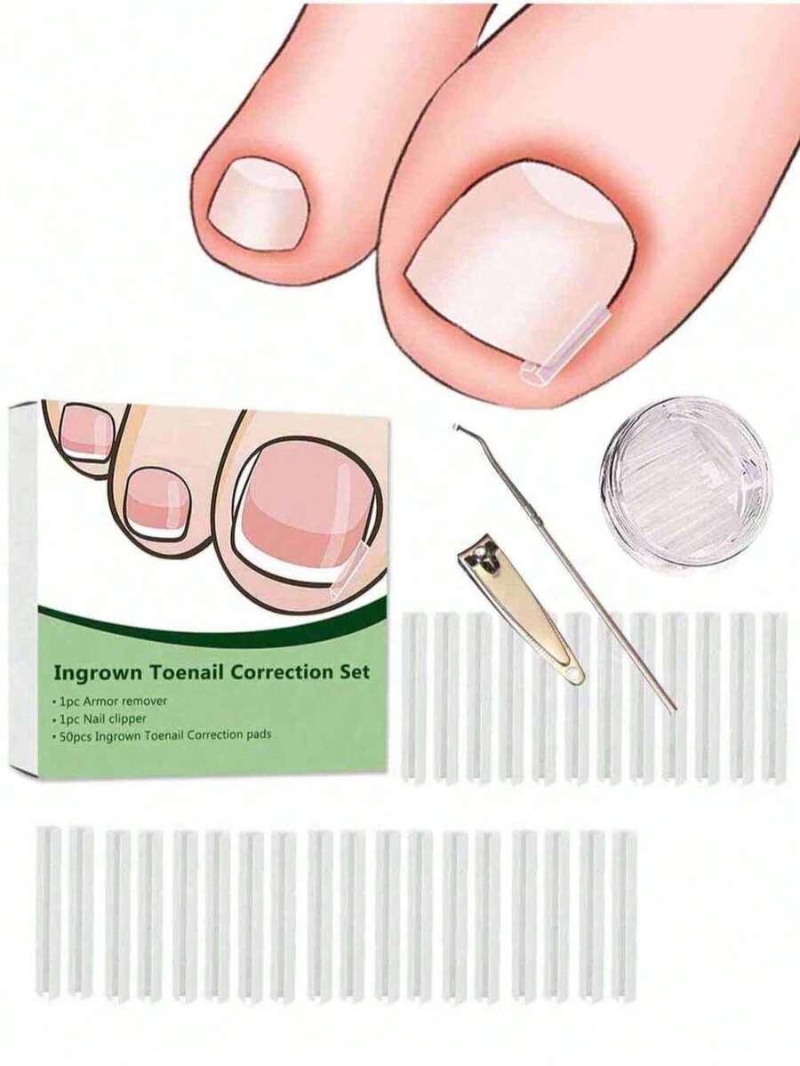 （50+2 包嵌甲矫正治疗套装，50 片嵌甲矫正贴片，嵌甲修脚工具，嵌甲矫正贴片，含 2 个嵌甲提拉器和锉刀）