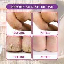 EELHOE 足浴盐 - 滋养肌肤，深层清洁，缓解肌肉酸痛，排毒，温暖双脚 - 薰衣草 - 查看 7