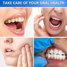 1/3pcs Niacinamide Whitening Toothpaste, Kimralur Triple Whitening Intensive Niacinamides Toothpastes, Fluoride-Free Formula Is Suitable For Sensitive Teeth - 1 Pcs - View 7