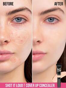 MISSLYN-SHOT IT LOUD!Cover Up Concealer, Concealer, Liquid Concealer, Even Skin Tone, CONCEALER With Light-Reflecting Pigments And Moisturizing Complex, Multi-Use Concealer, Lightweight, Full Coverage, Long Lasting - #09 - View 3