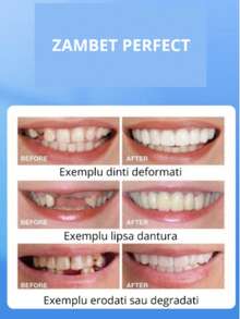 Dientes Falsos Para Restauración – Carillas Temporales De Emergencia - Multicolor - Ver 1