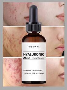 Hyaluronic Acid Facial Serum | Deep Hydration And Moisture Lock, Suitable For All Skin Types, Nourishing And Radiant Complexion - Multicolor - View 3