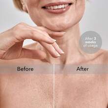 1pc Soothing Chest Support Pillow, Soft Cotton For Comfortable Sleep, Breast Support Pillow, Anti-Wrinkle, Washable, Hypoallergenic, Reduces Breast Lines, Suitable For Nursing Bras