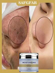 Deep Moisturizing Cream | Hyaluronic Acid + Jojoba Oil + Vitamin E + Honey Extract