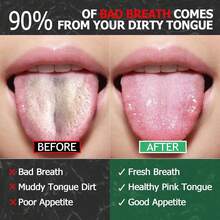 Nettoyeur de cure-dents en acier inoxydable, grattoir de langue en acier inoxydable pour les mauvaises halèines, outil de soins bucco-dentaires convenant à un usage personnel et pour animaux de compagnie - Argent - Voir 10