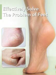 ANDVICTORY 2/4pcs Foot Scrubber/Foot File/Hard Skin Remover/Callus Remover/Stainless Steel Foot Scrubber/Foot Care Pedicure Tools - Multicolor - View 2