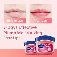 1pc/3pcs Vaseline Classic Intensive Care Lip Therapy, Romantic Early Cherry Blossom Scent, Osmanthus Scent, 7g, Vaseline Micro-Droplets, Cherry Blossom Extract, Lip Nourishing Care, Natural Glow, Christmas, Christmas Gift, Makeup, Skincare, Lip Care, Perfect - Rosebud Flavor - View 4
