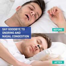 15-Day Supply Anti-Snoring Magnetic  Strips & Clips Set; Magnetic  Dilator Expander, Breathe Easy  Strips; External Magnetic  Patch; Magnetic  Band To Improve  Airflow & Relieve  Congestion; Anti-Snoring  Vent Strips To Improve Sleep - 15天量 - 查看 4