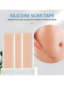 1roll Silicone Scar Sheets For Medical Grade Scar Tape Silicone Patches For C-Section Strips - Mauve Purple - View 2