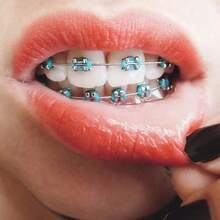 1-40件/套 多色弹性正畸结扎带 - 柔软高弹力牙套带 | 易于护理的口腔卫生套装 - 彩色 - 查看 2