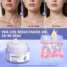 Crema para Cuello: 2PCS Crema Reafirmante Para El Cuello - Reduce las Arrugas y Líneas de Expresión, Reafirma y Levanta la Piel Flácida, Crema Hidratante para el Cuidado de la Piel (2) - 1 - Ver 1
