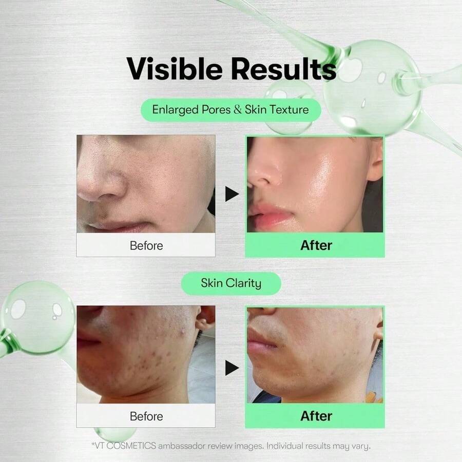 Collagen Reverse Aging Repairing Serum 50ml, Hydrating Serum For Face With Secretion Filtrate For Dull Skin & Fine Lines, Korean Skin Care - Grey - View 1