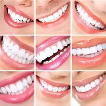 Special For Toothless People! Natural Dentures For Toothless, Red And White Simulation Of The Upper And Lower Styles, Comfortable And Easy To Disassemble, Easy To Improve Confidence - Phù hợp với người không có răng - Xem 4