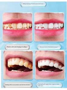 Manual Teeth Stain Remover, Tartar Scraper, Teeth Whitening Tool, Teeth Stain Cleaning Stick, Professional Teeth Polishing & Bleaching Cleaner, Manual Teeth Cleaning Device, Teeth Stain Remover, Tooth Plaque Eraser, Teeth Stain Cleaning Brush, Teeth Cleaning Micro-Abrasive Tool For Removing Tobacco, Tea, Tartar And Calculus Stains, Reusable And Washable With Water - Multicolor - View 4