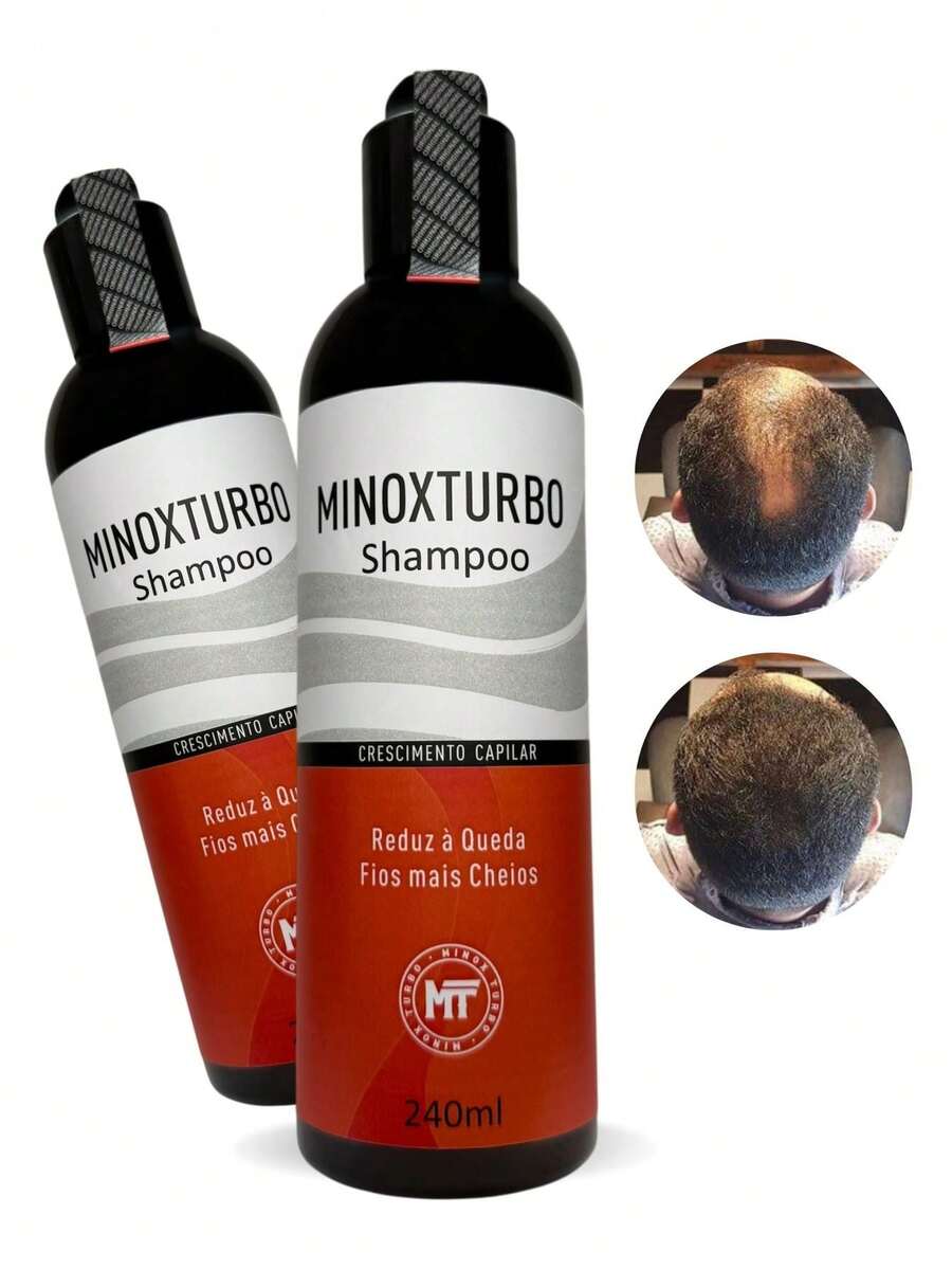 MINOXTURBO Original Hair Growth Shampoo Anti-Hair Loss 240ml - màu đen - Xem 1