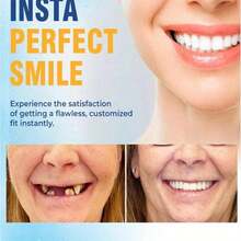 Special For Toothless People! Natural Dentures For Toothless, Red And White Simulation Of The Upper And Lower Styles, Comfortable And Easy To Disassemble, Easy To Improve Confidence - Phù hợp với người không có răng - Xem 6