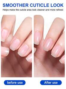 TWOING 角质软化液 30ml 指甲角质软化剂 植物性指甲滋养护理 角质保湿 防倒刺指甲边缘 指甲护理工具 - 白色 - 查看 7