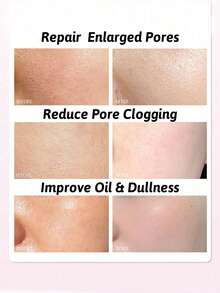 100毫升 7% 甘醇酸爽肤水，7% 甘醇酸爽肤水，面部去角质，收缩毛孔，焕活肌肤（3.38 液体盎司）