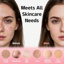 Electric Face Scrubber Waterproof Silicone Facial Cleansing Brush For Women And Men 2 Modes Rechargeable Electric Exfoliator Scrubber For Deep Cleaning Exfoliating Massaging - Hồng - Xem 3