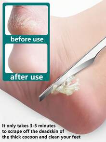 Dụng cụ dao cắt móng chân Dụng cụ chà chân chuyên nghiệp bằng thép không gỉ Dụng cụ cạo chân Dụng cụ cạo da chết Dụng cụ cạo da chết Dụng cụ cắt móng chân Dụng cụ chăm sóc chân cho nam nữ - Bạc - Xem 5