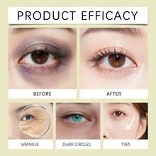 1支/2支/3支装视黄醇眼霜，保湿、减少皱纹、滋养眼部精华，专为娇嫩眼周肌肤设计 - 螢光黃+灰色 - 查看 10