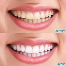 3pcs Multi-Functional Teeth Whitening & Cleaning Scraper, Manual Toothbrush, Oral Care, Plaque Remover, Dental Tools - Multicolor - View 3