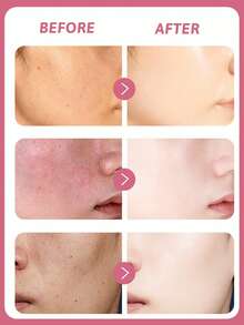 Pond's 旁氏无瑕亮白霜，200克，2-4周淡化色斑，减少色素沉着，舒缓干燥，均匀肤色，锁住营养，提亮暗沉，长效保湿，轻盈配方，蕴含双重维生素B3+C，经皮肤科医生测试，深层滋润。 - Whitening&fading spots - 查看 2