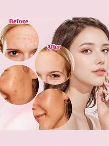 5pcs Micro Needle Acne Removal Tool Kit, Y2K Goth Travel Essentials - Pen Accessories, Sweatshirt, Strawberry Liquid Blush, Sleep Cap, Brooch, Vanity Makeup Brush, Foundation - Multicolor - View 9