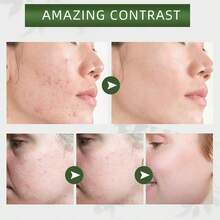 2pcs,Green Tea Mud Film, Deeply Cleanses Pores, Removes Blackheads, Delicately Shrinks Pores, Gently Cleanses, Controls Oil, Moisturizes, Smear-Type Mud Film Stick - 綠色 - 查看 6