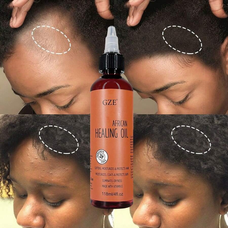 GZE 非洲修复油，适用于干性、受损及天然发质 | 柔顺、强韧、增添亮泽，终极护发灵药 - 棕色 - 查看 1