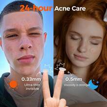 36/360片装水胶体祛痘贴，日夜两用，温和不刺激 - 防水透气，遮盖瑕疵、痘痘和皮肤瑕疵，面部及肌肤护理祛痘贴 - 隐形超薄必备 - 彩色 - 查看 4