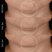 Lancôme 兰蔻 Rénergie H.P.N 300 胜肽面霜 75ml - 白紫 - 查看 5