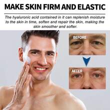 EAST MOON 3pcs Men's Cream With 5.29 Oz Of Collagen, Moisturizing Complex With Retinol | Rich In Hyuronic Acid, Firms And Repairs Skin, Replenishes Skin Moisture, Smoothes Facial Care, Moisturizes, Smears, Lifts And Restores Youth And Vitality Cream. Father's Day Gift - Blue - View 6